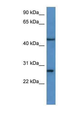 Western Blot: FGFBP2 Antibody [NBP1-79846]