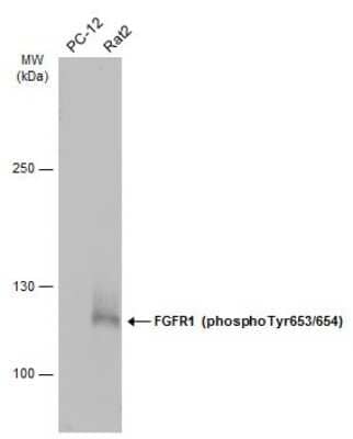 Western Blot: FGFR1 [p Tyr653, p Tyr654] Antibody [NBP3-13251]