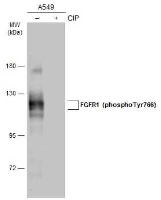 Western Blot: FGFR1 [p Tyr766] Antibody [NBP3-13240]