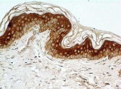 Immunohistochemistry-Paraffin: FGFR1 Antibody (M17A3) - Azide and BSA Free [NBP2-80732]