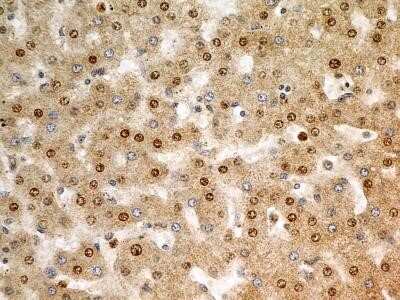 Immunocytochemistry: FGFR1 Antibody (M17D10) - Azide and BSA Free [NBP2-80733]