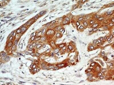 Immunohistochemistry-Paraffin: FGFR1 Antibody (M17D10) - Azide and BSA Free [NBP2-80733]
