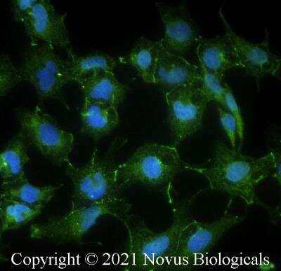Immunocytochemistry/ Immunofluorescence: FGFR1 Antibody (M17D10) - BSA Free [NB100-2080]