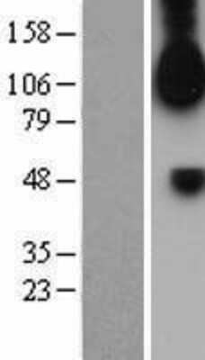 Western Blot: FGFR1 Overexpression Lysate [NBL1-10702]