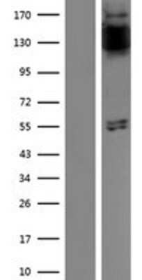 Western Blot: FGFR1 Overexpression Lysate [NBP2-09873]