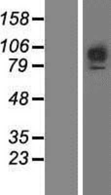 Western Blot: FGFR1 Overexpression Lysate [NBP2-09910]