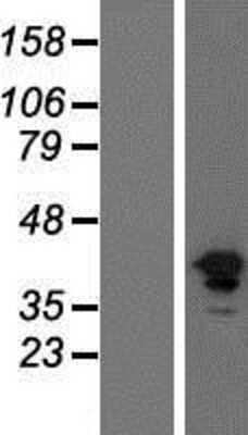 Western Blot: FGFR1 Overexpression Lysate [NBP2-09911]