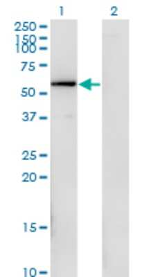 Western Blot: FGFR1OP Antibody (1E8) [H00011116-M02]