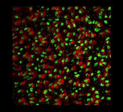 Immunohistochemistry-Frozen: FGFR1OP Antibody (2B1) [H00011116-M01]