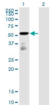 Western Blot: FGFR1OP Antibody (2B1) [H00011116-M01]