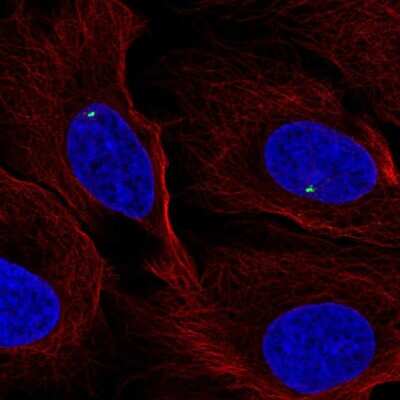 Immunocytochemistry/ Immunofluorescence: FGFR1OP Antibody [NBP2-57930]