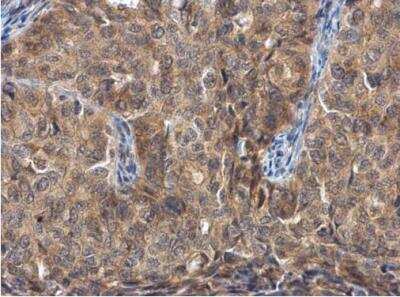 Immunohistochemistry-Paraffin: FGFR1OP Antibody [NBP2-16478]