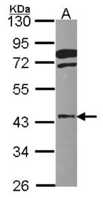 Western Blot: FGFR1OP Antibody [NBP2-16478]