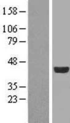 Western Blot: FGFR1OP Overexpression Lysate [NBL1-10704]