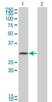 Western Blot: FGFR1OP2 Antibody (2G4) [H00026127-M01]