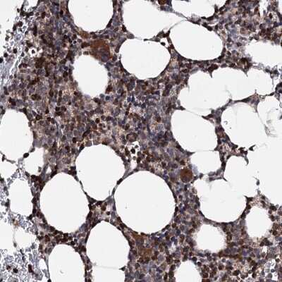 Immunohistochemistry-Paraffin: FGFR1OP2 Antibody [NBP1-84148]