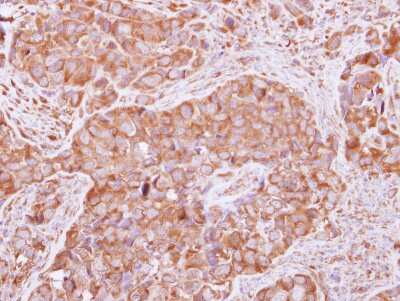 Immunohistochemistry-Paraffin: FGFR1OP2 Antibody [NBP2-16479]