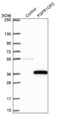 Western Blot: FGFR1OP2 Antibody [NBP1-84148]