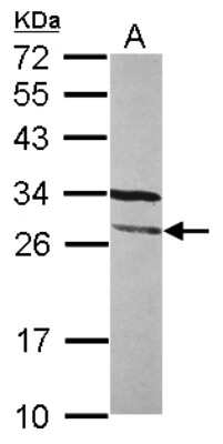 Western Blot: FGFR1OP2 Antibody [NBP2-16479]