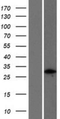 Western Blot: FGFR1OP2 Overexpression Lysate [NBP2-07139]