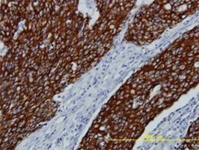 Immunohistochemistry-Paraffin: FGFR2 Antibody (1G3) [H00002263-M01]