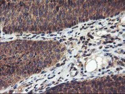 Immunohistochemistry-Paraffin: FGFR2 Antibody (OTI5C5) [NBP2-00932]