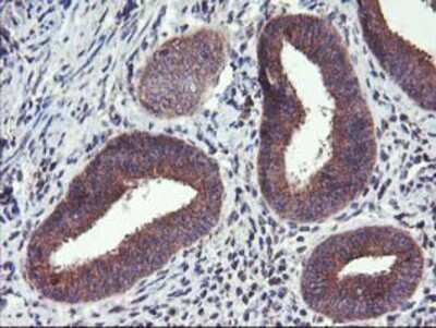 Immunohistochemistry-Paraffin: FGFR2 Antibody (OTI5C5) [NBP2-00932]