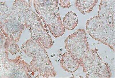 Immunohistochemistry: FGFR2 Antibody [NB200-642]