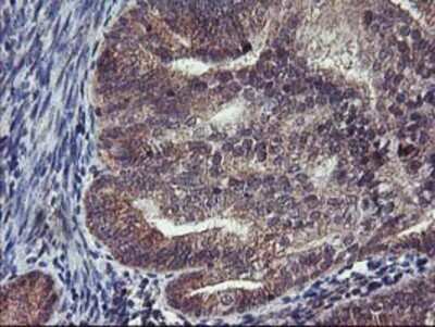 Immunohistochemistry: FGFR2 Antibody (OTI5C5) - Azide and BSA Free [NBP2-70731]