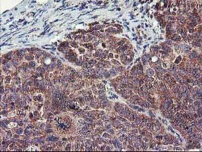 Immunohistochemistry: FGFR2 Antibody (OTI5C5) - Azide and BSA Free [NBP2-70731]