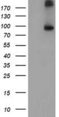 Western Blot: FGFR2 Antibody (OTI5C5)Azide and BSA Free [NBP2-70731]