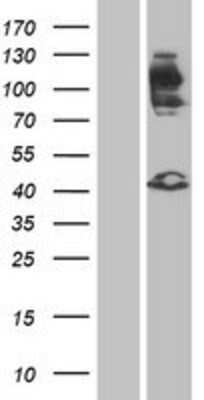 Western Blot: FGFR2 Overexpression Lysate [NBP2-04392]