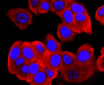Immunocytochemistry/ Immunofluorescence: FGFR3 Antibody (JM110-33) [NBP2-66840]