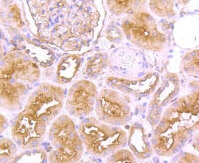 Immunohistochemistry-Paraffin: FGFR3 Antibody (JM110-33) [NBP2-66840]