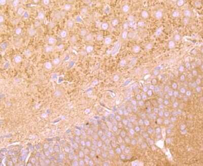 Immunohistochemistry-Paraffin: FGFR3 Antibody (JM110-33) [NBP2-66840]