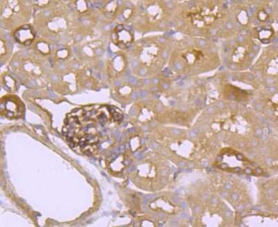 Immunohistochemistry-Paraffin: FGFR3 Antibody (JM110-33) [NBP2-66840]