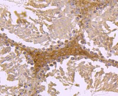 Immunohistochemistry-Paraffin: FGFR3 Antibody (JM110-33) [NBP2-66840]