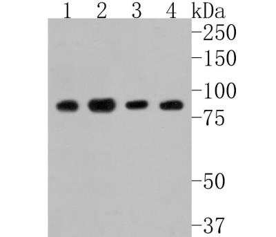 Western Blot: FGFR3 Antibody (JM110-33) [NBP2-66840]