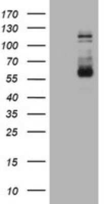 Western Blot: FGFR3 Antibody (OTI1B10)Azide and BSA Free [NBP2-70722]