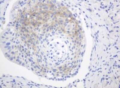 Immunohistochemistry: FGFR3 Antibody (OTI1B10) [NBP2-45716]