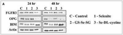 Western Blot: FGFR3 Antibody [NB600-1509]