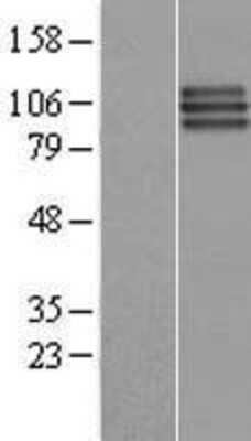 Western Blot: FGFR3 Overexpression Lysate [NBP2-09054]