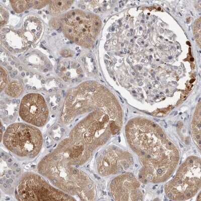 Immunohistochemistry-Paraffin: FGFR4 Antibody [NBP1-84585]