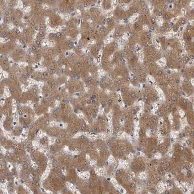 Immunohistochemistry-Paraffin: FGFR4 Antibody [NBP1-84585]