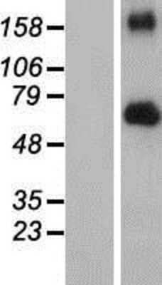 Western Blot: FGFR4 Overexpression Lysate [NBP2-06375]