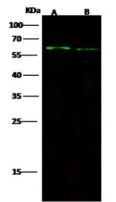 Western Blot: FGFR5/FGFRL1 Antibody (019) [NBP2-90467]