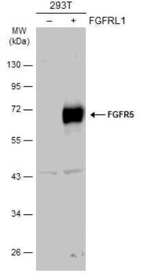 Western Blot: FGFR5/FGFRL1 Antibody [NBP1-31461]