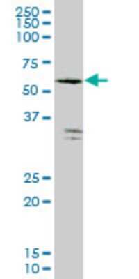 Western Blot: FGGY carbohydrate kinase domain containing Antibody (3B9) [H00055277-M04]