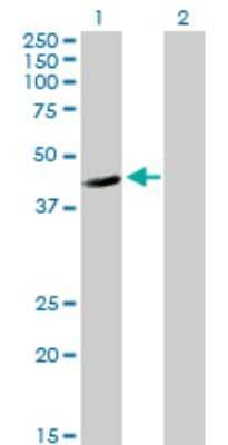 Western Blot: FGGY carbohydrate kinase domain containing Antibody [H00055277-B01P]