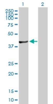 Western Blot: FGGY carbohydrate kinase domain containing Antibody [H00055277-D01P]